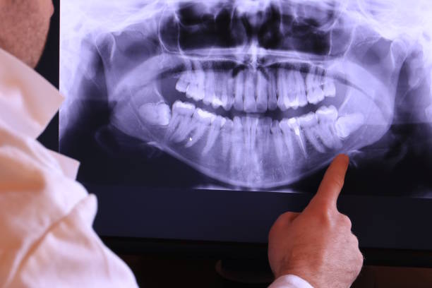 Best Emergency Dentist for Knocked-Out Tooth in Odessa, FL