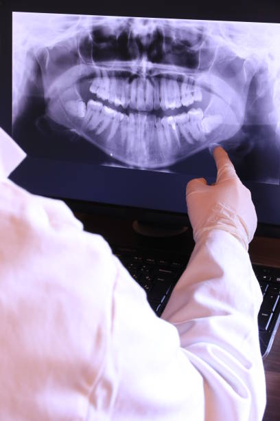 Best Emergency Dentist for Lost Fillings or Crowns in Odessa, FL